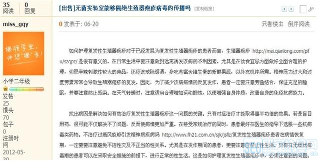 如何判断seo优化外链是否为垃圾链接-百度站长平台lee最新公布