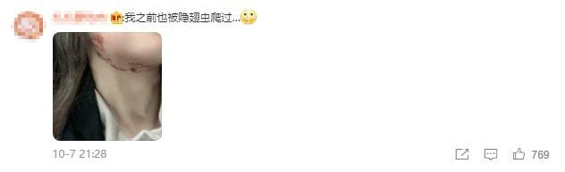别再关灯玩手机了!网友深夜玩手机差点毁容,背后原因细思极恐