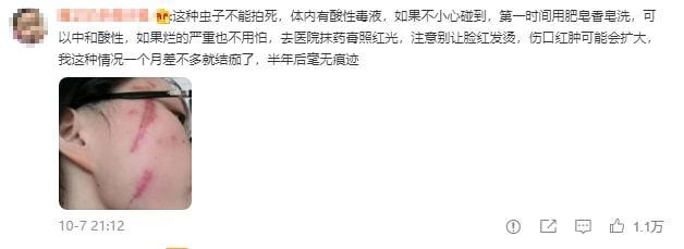 别再关灯玩手机了!网友深夜玩手机差点毁容,背后原因细思极恐